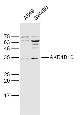 AKR1B10 antibody