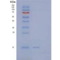 人微管关联蛋白1轻链3α(MAP1LC3a)重组蛋白C-6His