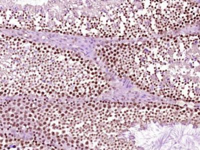 phospho-Src (Ser75) antibody