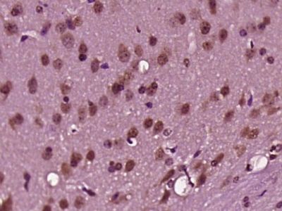 phospho-c-Jun (Ser63) antibody