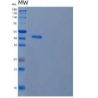人淋巴组织中表达的受体重组蛋白