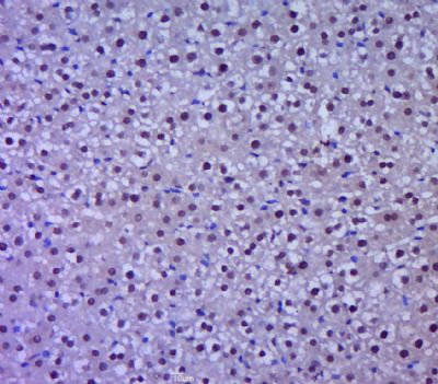 PRSS23丝氨酸蛋白酶23抗体