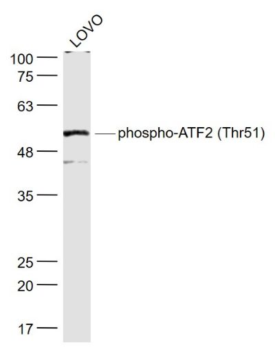 phospho-ATF2 (Thr51)磷酸化活化复制因子2
