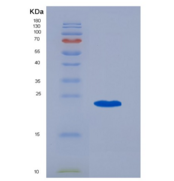 人CD20 / MS4A1重组蛋白TrxA Tag