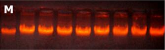 柱式细菌DNA提取试剂盒