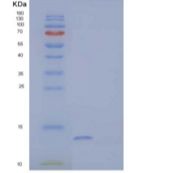 人序列相似家族19成员A4(FAM19A4)重组蛋白N-6His