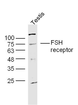 FSH receptor促卵泡刺激素受体抗体