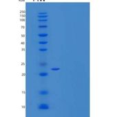 小鼠SLAM家族成员9/SLAMF9/CD2F-10重组蛋白C-6His