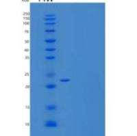 小鼠SLAM家族成员9/SLAMF9/CD2F-10重组蛋白C-6His