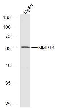 MMP13 antibody