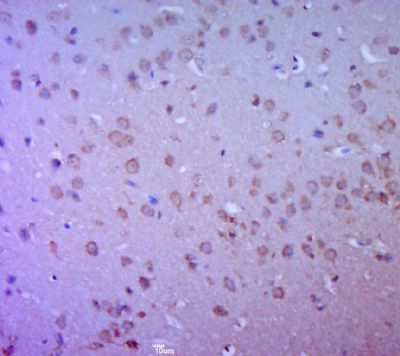 phospho-SYN1(Ser62+Ser67) anti