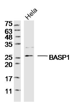 BASP1脑富含膜附着信号蛋白1抗体