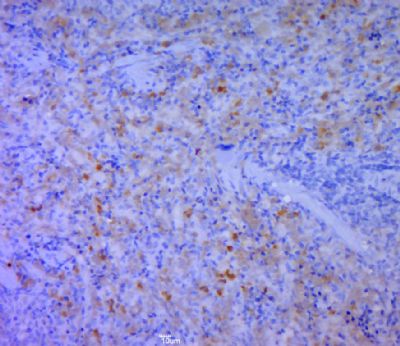 CD5L antibody