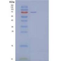 人白介素35(IL35)重组蛋白