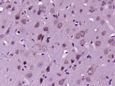 MARK2丝氨酸/苏氨酸蛋白激酶MARK2抗体