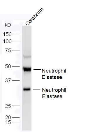 Neutrophil Elastase中性粒细胞弹性蛋白酶E