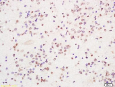 PIRH2泛素连接酶抗体