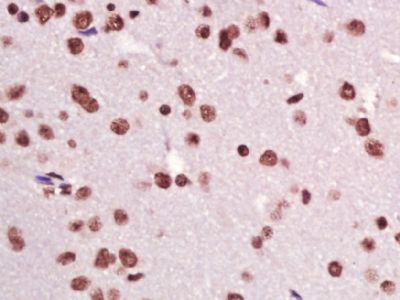 CIDEC细胞死亡活化蛋白抗体