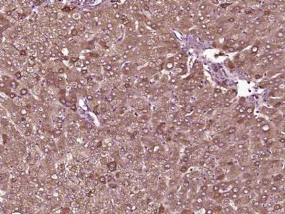 TTR/Prealbumin转甲状腺素蛋白/前白蛋白单克隆抗