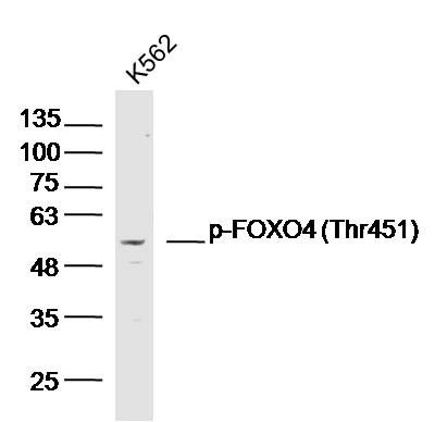 phospho-FOXO4 (Thr451) antibod