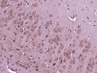 IGF 1胰岛素样生长因子1抗体