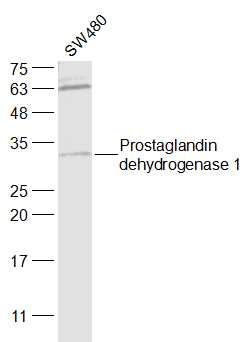 Prostaglandin dehydrogenase 1 