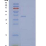 人白介素1受体Ⅱ(IL1R2)重组蛋白