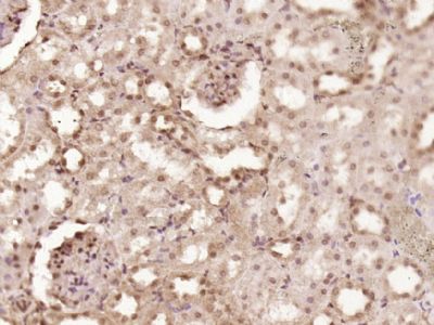 CDKN2B/p15 INK4b细胞周期蛋白依赖性激酶抑制剂