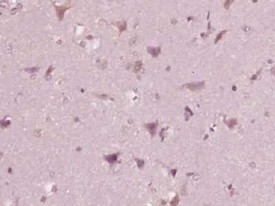 Phospho-c-Kit(Ser721)磷酸化原癌基因c-