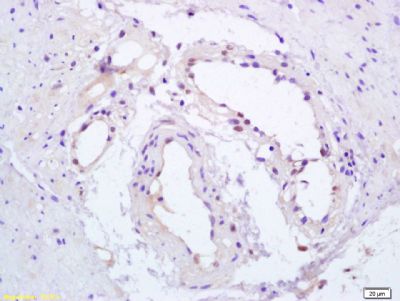 Phospho-PPAR Gamma (Ser112) an