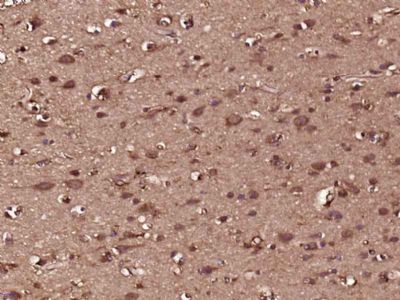 OLFML2B嗅介蛋白样蛋白2B抗体