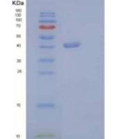 人G-CSF / CSF3重组蛋白Fc tag