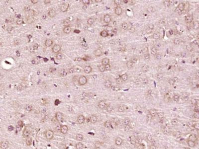 POMC阿黑皮素原抗体