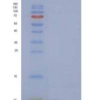 人C-C基序趋化因子11/ccl 11/嗜酸性粒细胞趋化因子重组蛋白