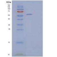 人α-淀粉酶2B/AMY2B重组蛋白C-6His