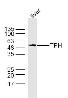 色氨酸羟化酶抗体TPH