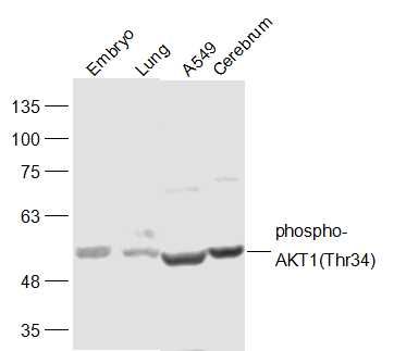 phospho-AKT1(Thr34)磷酸化蛋白激酶B抗体
