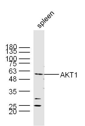 AKT1蛋白激酶B抗体