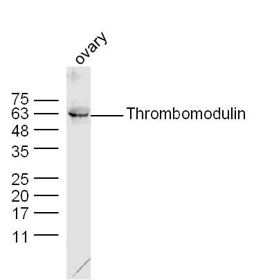 Thrombomodulin antibody