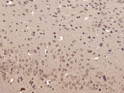 phospho-RPS6KB1(Ser417)磷酸化核糖体S