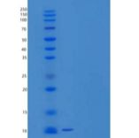 人C-C基序趋化因子8/CCL8/MCP-2重组蛋白C-6His