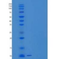 人C-C基序趋化因子8/CCL8/MCP-2重组蛋白C-6His