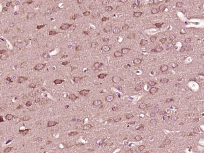 phospho-Alpha synuclein (Tyr13