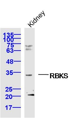 RBKS核糖激酶RBKS抗体