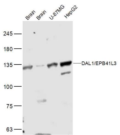 DAL1/EPB41L3细胞骨架4.1蛋白家族DAL1抗体