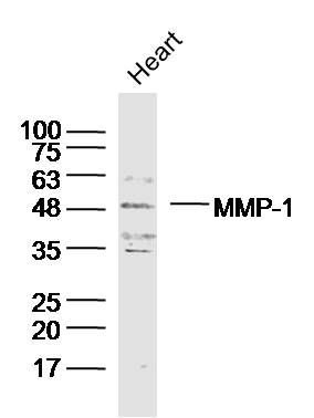 MMP1 antibody