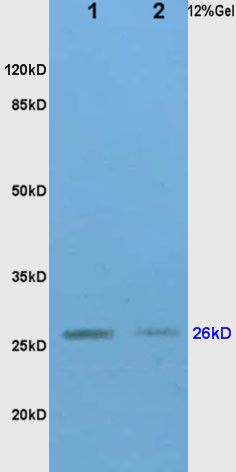 TIMP-1 antibody