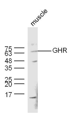 Growth hormone receptor antibo