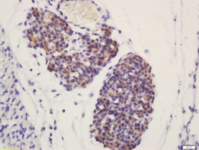 phospho-ATG4D (Ser467)磷酸化自噬相关蛋