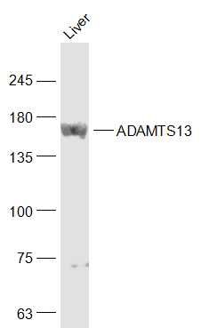 ADAMTS13 antibody